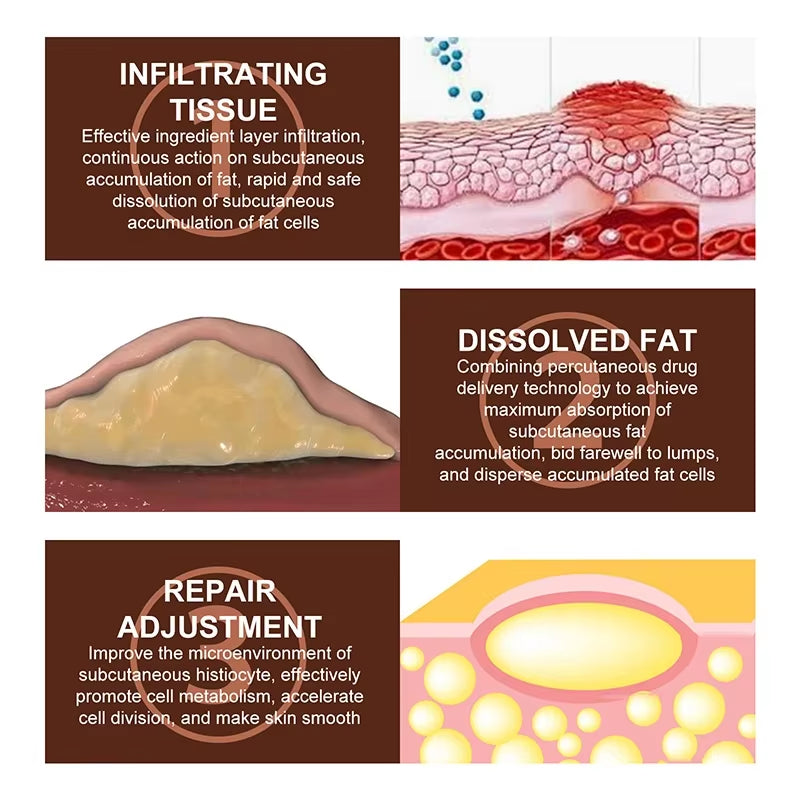 Skin Care Soothing Knot Care Cream Subcutaneous Lumps Remover Relieves Body Agglomeration Hard Blocks Body Skin Care Cream - Timeless Beauty