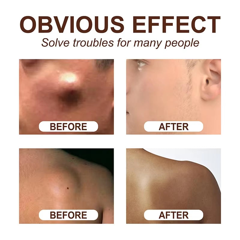 Skin Care Soothing Knot Care Cream Subcutaneous Lumps Remover Relieves Body Agglomeration Hard Blocks Body Skin Care Cream - Timeless Beauty