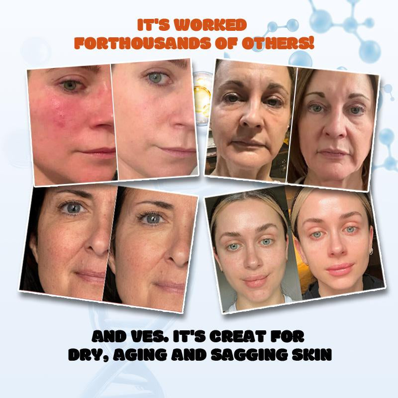 ACM Aavini Collagen Moisture Filler & Combleur Cream | Lightweight, Hydrating, and Firming in One Bottle | Additive-Free, Suitable for Sensitive Skin - Timeless Beauty