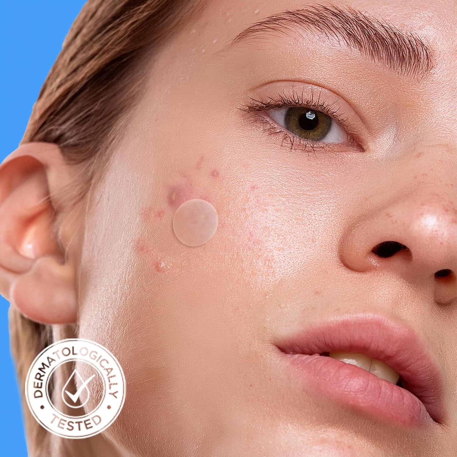Acne Cover Patches, FSA HSA Eligible Hydrocolloid Pimple Patches for Face with Tea Tree Oil, Korean Skincare Zit Patches for Face | FSA HSA Store Eligible Items | Vegan, Cruelty-Free - Timeless Beauty