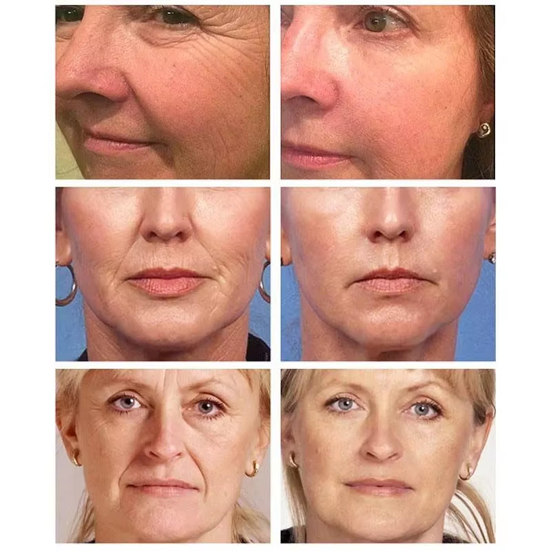 Instant Remove Wrinkle Serum Firming Lifting Anti-Aging Fade Fine Lines Improve Puffiness Moisturizing Brighten Face Skin Care - Timeless Beauty