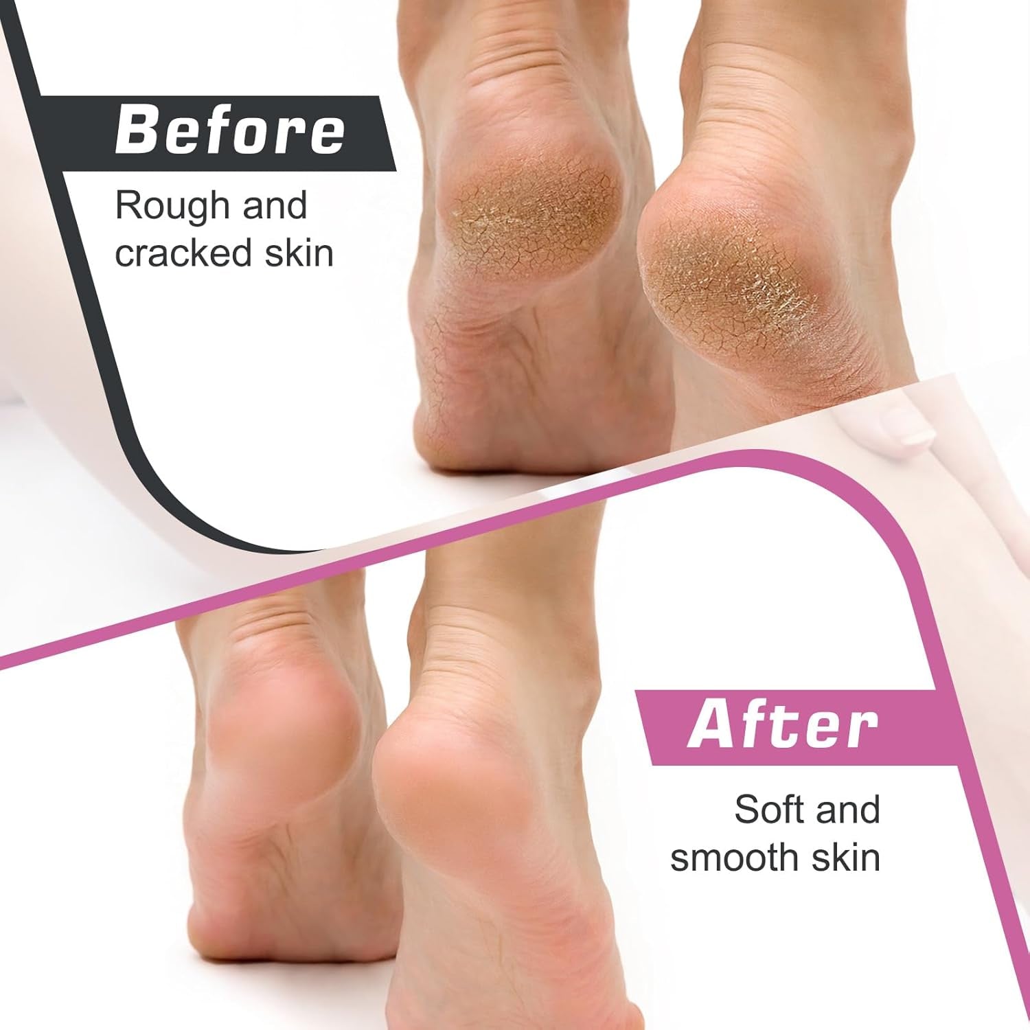 Electric Callus Remover, Foot Nail File Grinder Tool with Speed Controller and 60PCS Replacement Sandpaper Disk, Pedicure Tool Feet Scrubber for Dead Dry Crack Skin Calluses