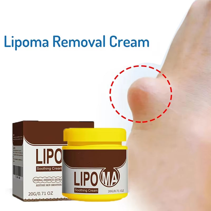 Skin Care Soothing Knot Care Cream Subcutaneous Lumps Remover Relieves Body Agglomeration Hard Blocks Body Skin Care Cream - Timeless Beauty