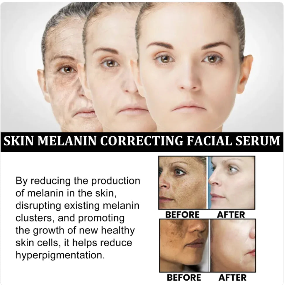 Facial Treatment for Dark Spots and Fine Lines - Timeless Beauty