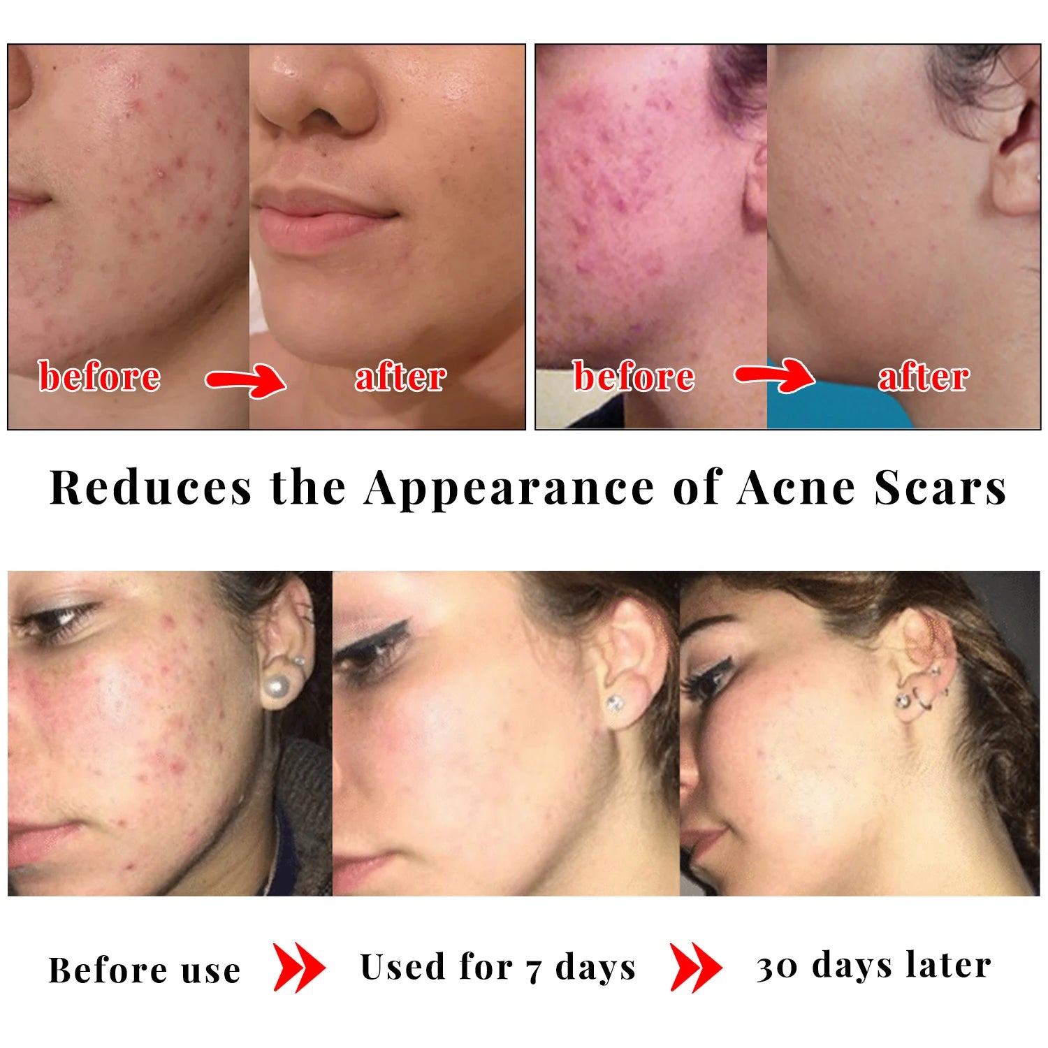 65G X2 Kojic Acid Soap Skin Lightening Even Skin Tone Facial Deep Cleaning Oil Control Moisturizing Skin Care Beauty Health - Timeless Beauty