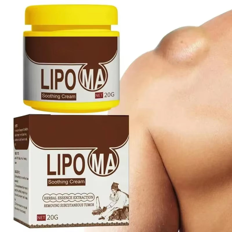 Skin Care Soothing Knot Care Cream Subcutaneous Lumps Remover Relieves Body Agglomeration Hard Blocks Body Skin Care Cream - Timeless Beauty
