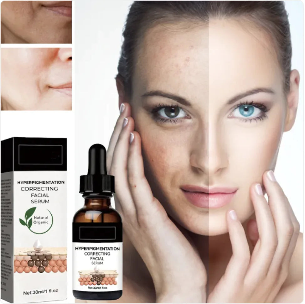 Facial Treatment for Dark Spots and Fine Lines - Timeless Beauty