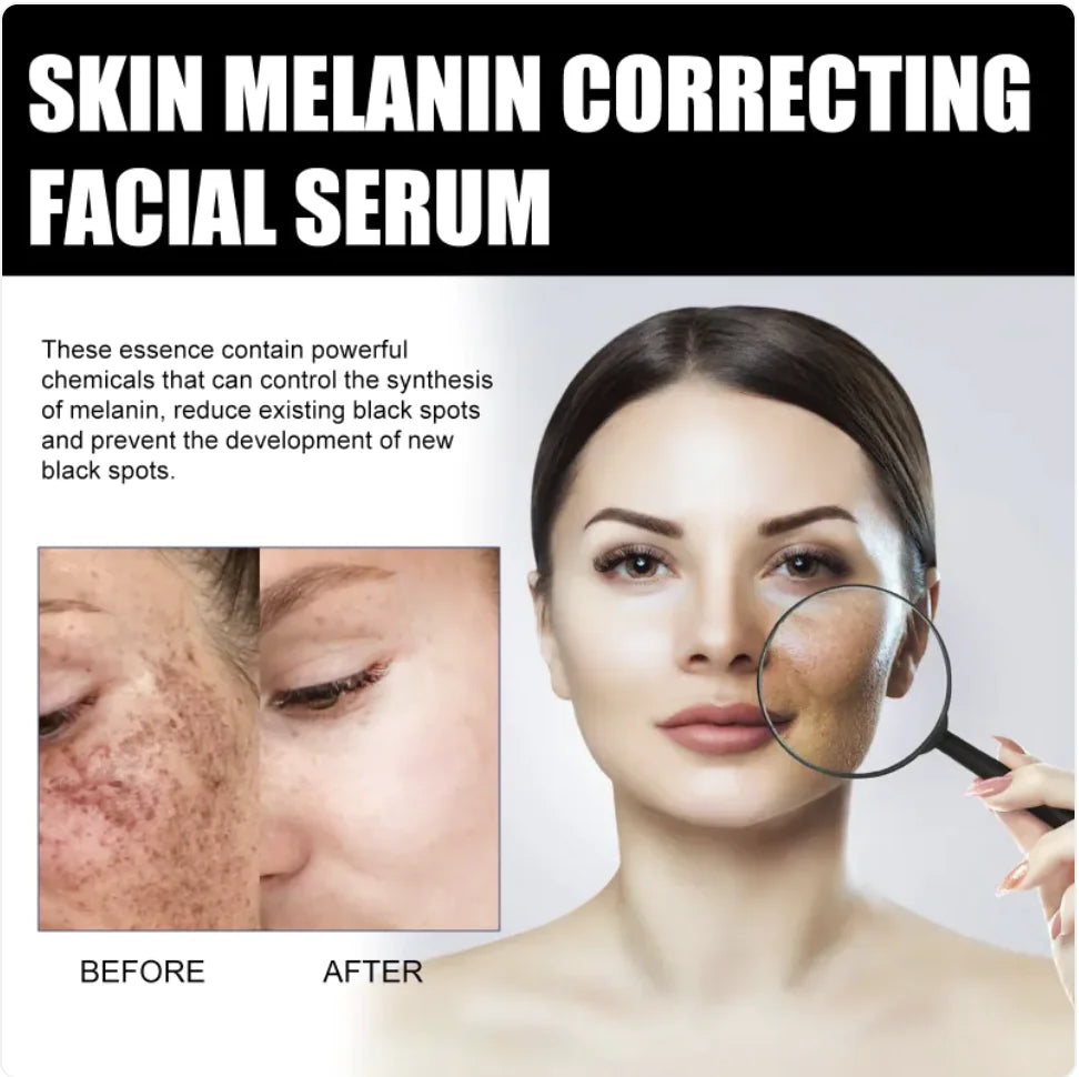 Facial Treatment for Dark Spots and Fine Lines - Timeless Beauty