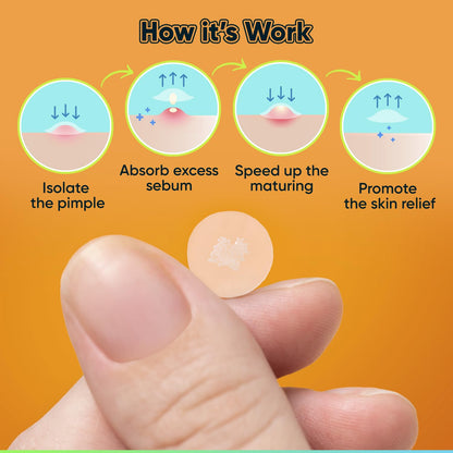 Pimple Patches for Face with Tea Tree Oil 216 Pcs. Hydrocolloid Acne Pimple Patches. Blemish Patches, Acne Dots, Pimple Stickers, Acne Patch and Pimple Patch - Timeless Beauty