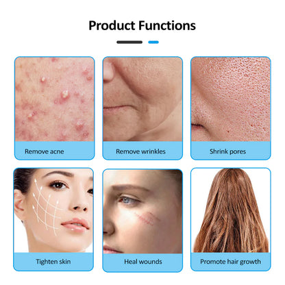 4-in-1 High Frequency Skin Therapy Wand - Timeless Beauty