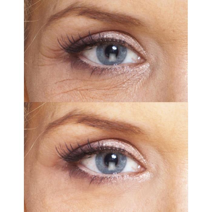 Ageless Beauty: Eye Repair Cream + Antioxidant Serum + Repair Night - Timeless Beauty