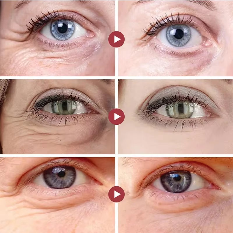 Collagen Eye Mask Wrinkle Remove Eyes Patches Firming Lifting Fade Fine Lines Hyaluronic Acid Moisturizing Smooth Eye Skin Care - Timeless Beauty