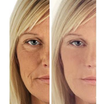 C+ Antioxidant Wrinkle Reduction Serum - Timeless Beauty