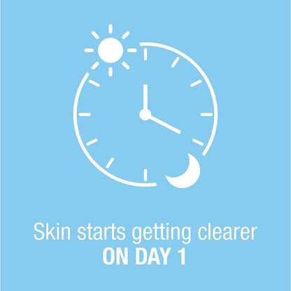 On-The-Spot Acne Treatment Gel with Benzoyl Peroxide - Gentle Face Acne Medicine for Acne Prone Skin, 0.75 Oz - Timeless Beauty