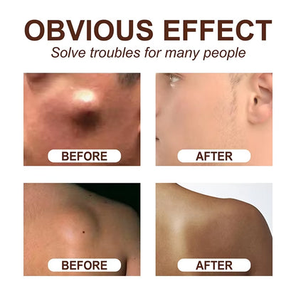 Skin Care Soothing Knot Care Cream Subcutaneous Lumps Remover Relieves Body Agglomeration Hard Blocks Body Skin Care Cream - Timeless Beauty