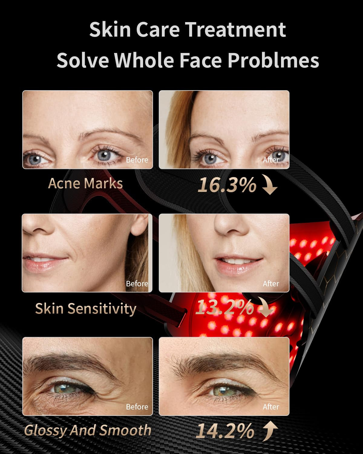 Face Mask Light 7 Colors Facial Mask Anti-Aging Tightening Skin (Black) - Timeless Beauty