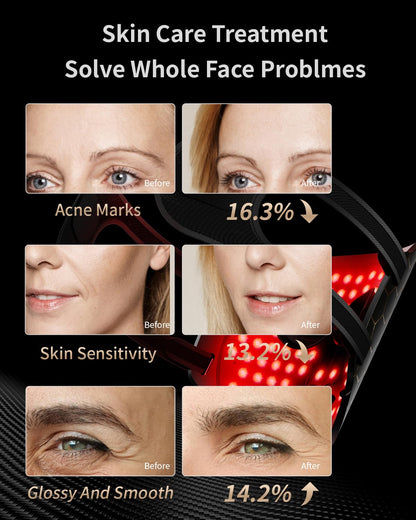 Face Mask Light 7 Colors Facial Mask Anti-Aging Tightening Skin (Black) - Timeless Beauty