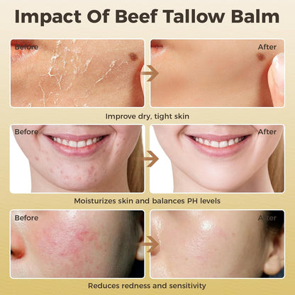 Beef Tallow for Skin, Premium Whipped Tallow Balm, Beef Tallow Moisturizer for Repairing Damaged Dry Skin, Grass Fed Beef Tallow for Skin Hydration, 4 Oz (BERGAMOT LAVENDER) - Timeless Beauty