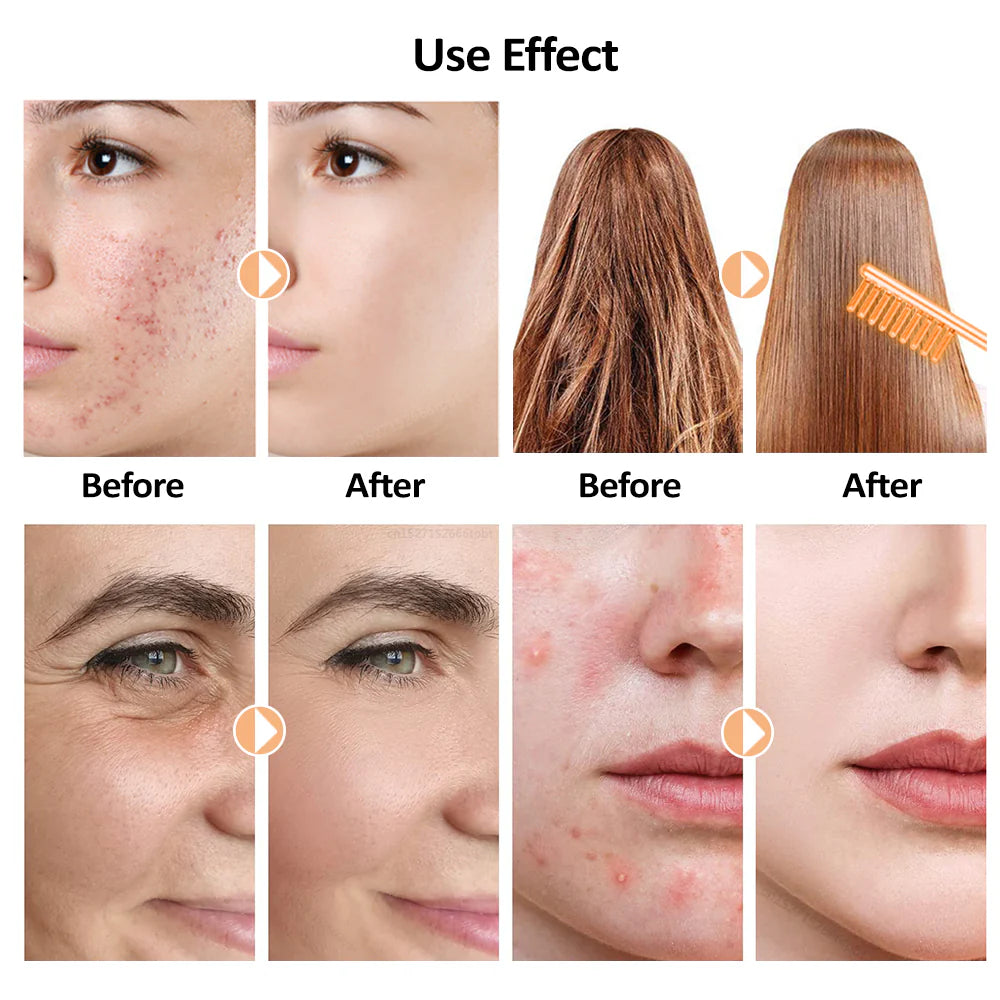 4-in-1 High Frequency Skin Therapy Wand - Timeless Beauty