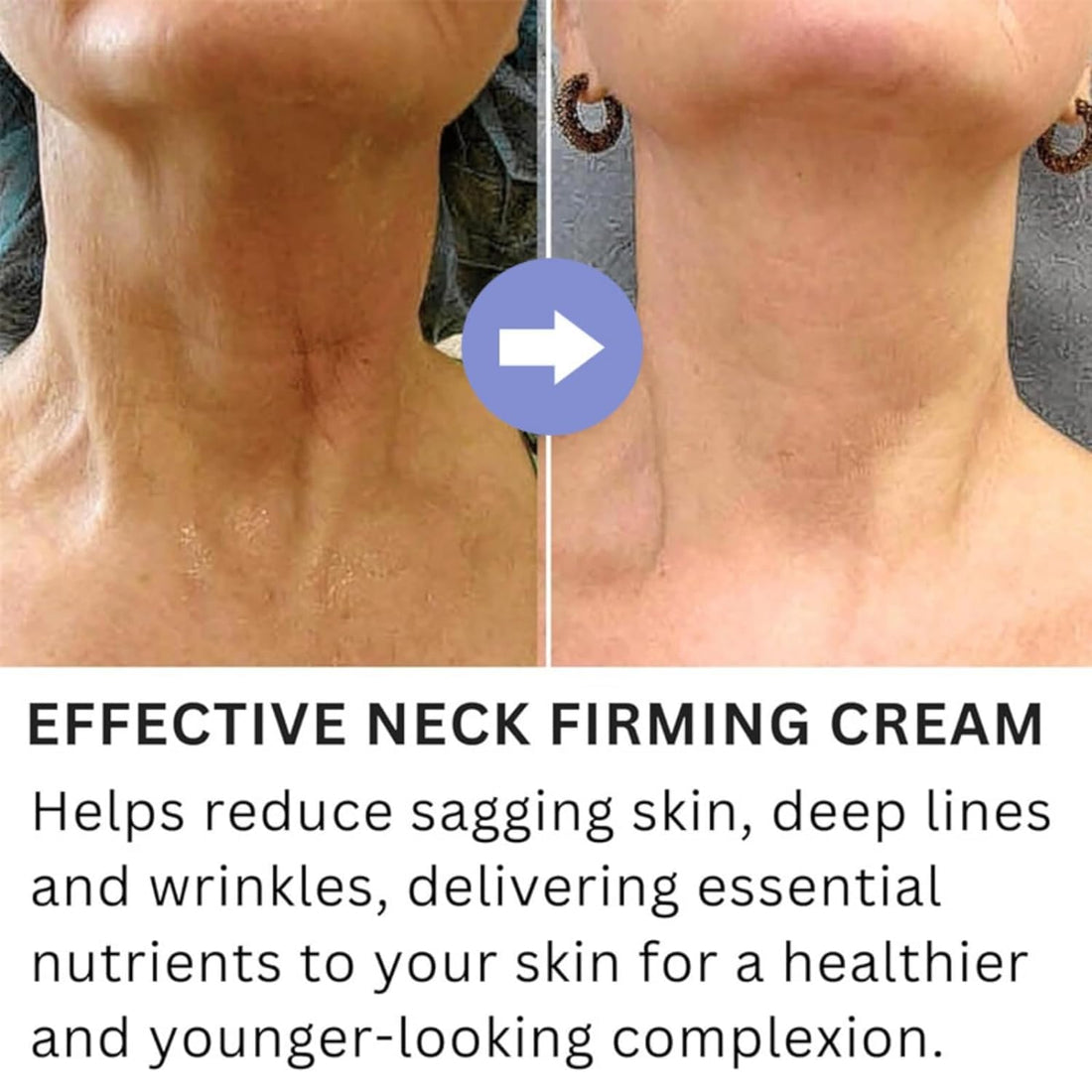 Neck Firming Cream, Tightening Lifting Sagging Wrinkles Anti-Aging Neck Cream, Neck Lift Firming - Timeless Beauty