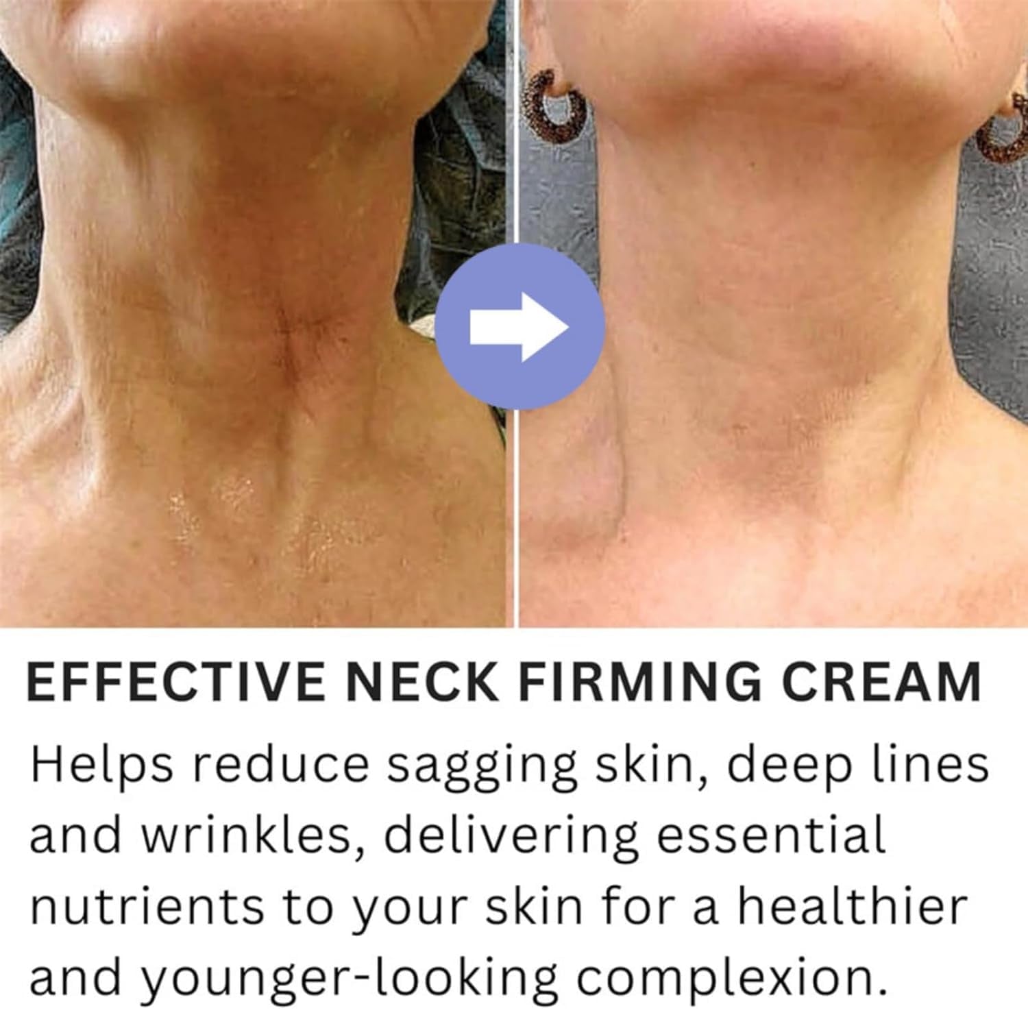 Neck Firming Cream, Tightening Lifting Sagging Wrinkles Anti-Aging Neck Cream, Neck Lift Firming - Timeless Beauty