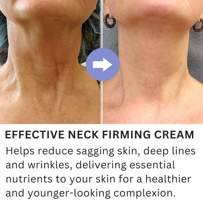 Neck Firming Cream, Tightening Lifting Sagging Wrinkles Anti-Aging Neck Cream, Neck Lift Firming - Timeless Beauty