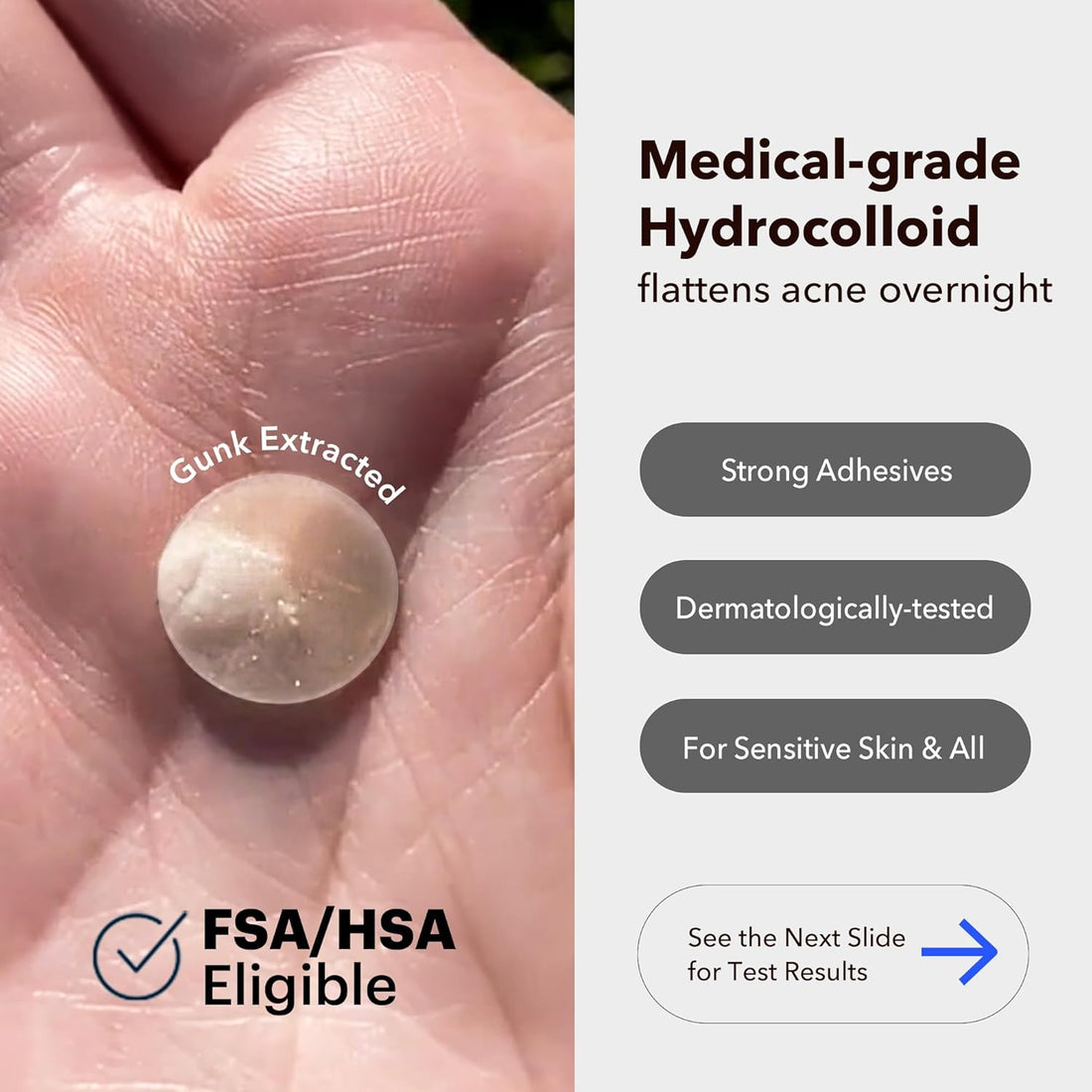 Acne Cover Patches, FSA HSA Eligible Hydrocolloid Pimple Patches for Face with Tea Tree Oil, Korean Skincare Zit Patches for Face | FSA HSA Store Eligible Items | Vegan, Cruelty-Free - Timeless Beauty