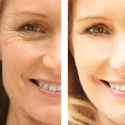 C+ Antioxidant Wrinkle Reduction Serum - Timeless Beauty