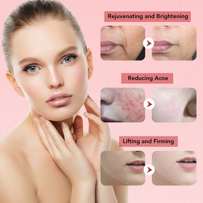 7 In 1 RF Face Massager Skin Rejuvenation Mesotherapy Facial Lifting - Timeless Beauty