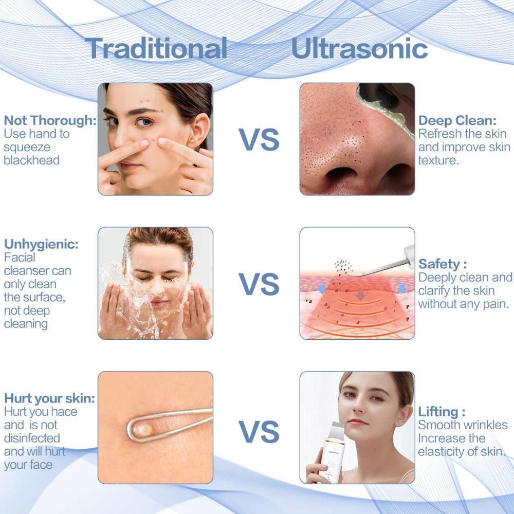 New Ultrasonic Ion Face Cleansing Skin Scrubber Peeling Shovel EMS - Timeless Beauty