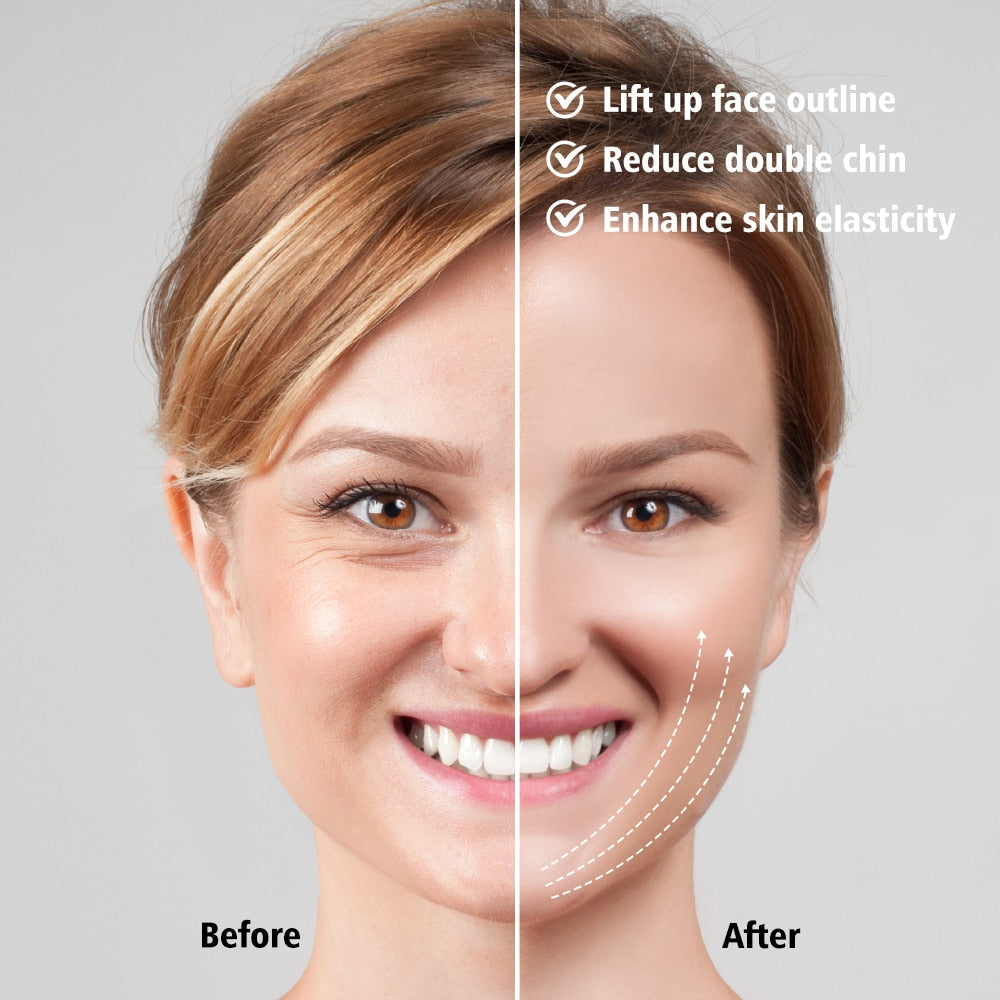 EMS Facial Lifting Device Facial Massager Chin V Line Belt - Timeless Beauty