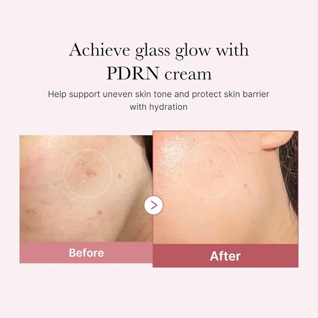 Medicube PDRN Pink Hyaluronic Moisturizing Cream Harlequin Chestnut