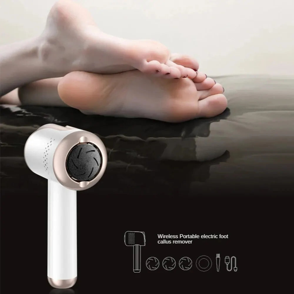 Automatic Foot Grinding Device New Style Beauty Foot To Remove Dead - Timeless Beauty
