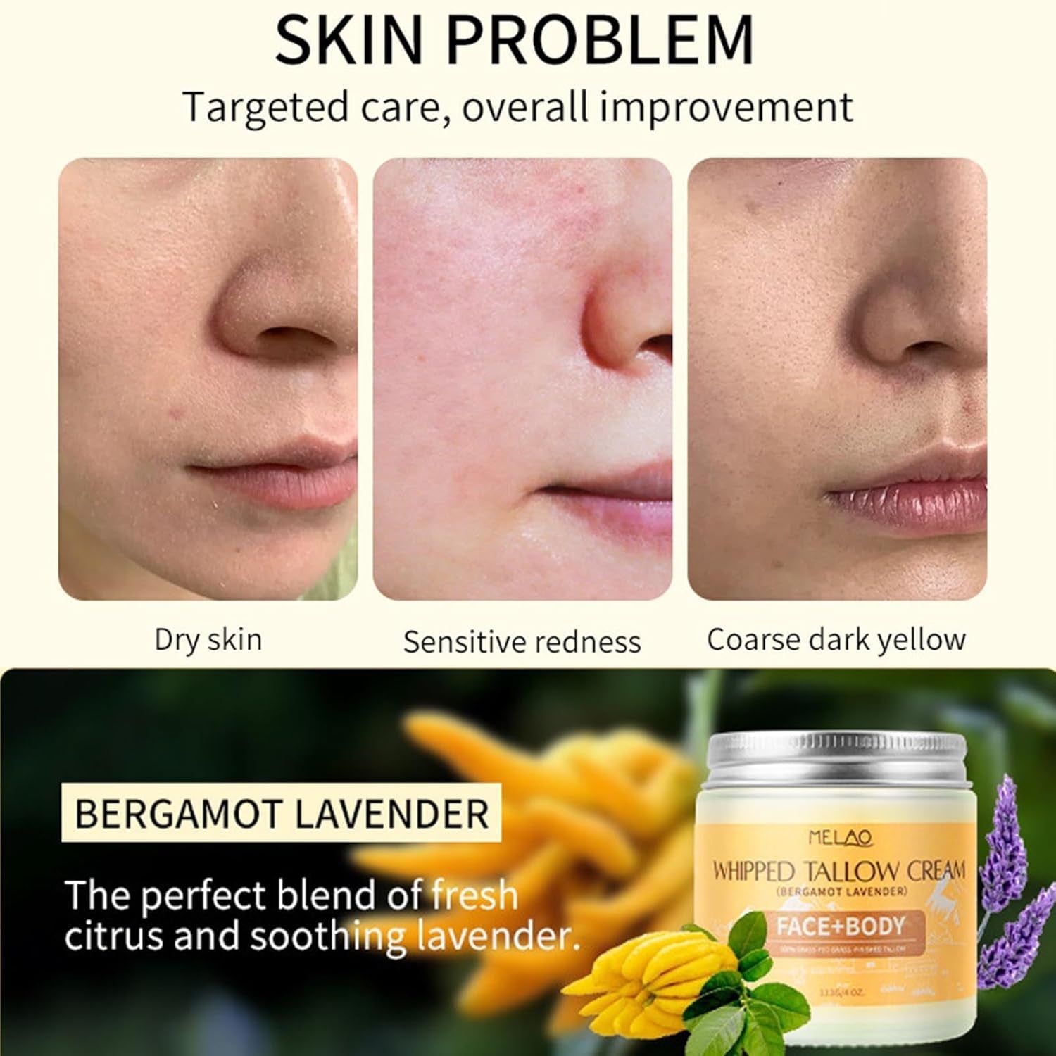 Beef Tallow for Skin, Premium Whipped Tallow Balm, Beef Tallow Moisturizer for Repairing Damaged Dry Skin, Grass Fed Beef Tallow for Skin Hydration, 4 Oz (BERGAMOT LAVENDER) - Timeless Beauty