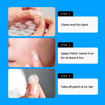 Acne Cover Patches, FSA HSA Eligible Hydrocolloid Pimple Patches for Face with Tea Tree Oil, Korean Skincare Zit Patches for Face | FSA HSA Store Eligible Items | Vegan, Cruelty-Free - Timeless Beauty