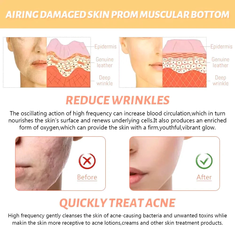 4-in-1 High Frequency Skin Therapy Wand - Timeless Beauty