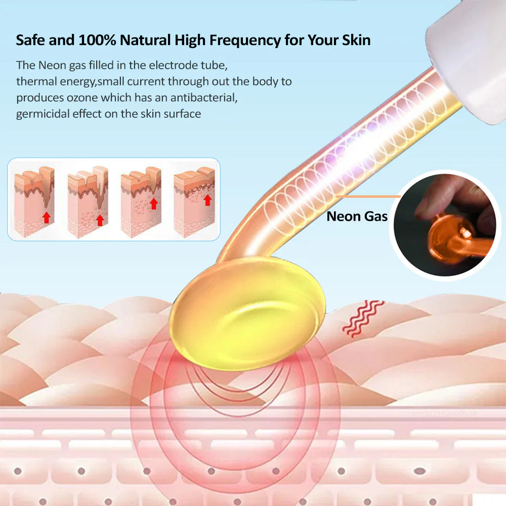 4-in-1 High Frequency Skin Therapy Wand - Timeless Beauty