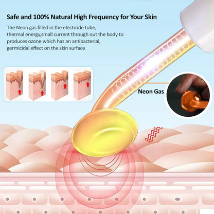 4-in-1 High Frequency Skin Therapy Wand - Timeless Beauty