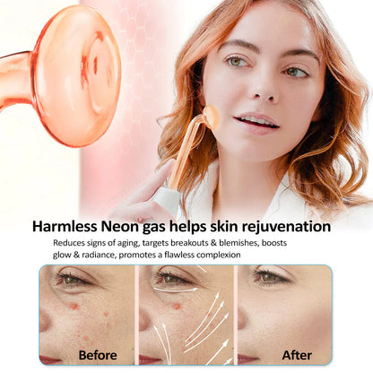 4-in-1 High Frequency Skin Therapy Wand - Timeless Beauty
