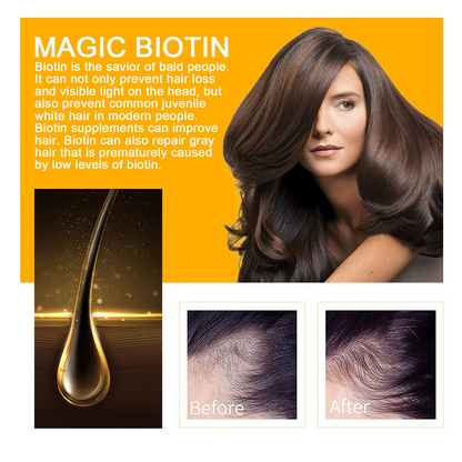 ELLHOE™ Biotin Hair Growth Spray – Strength Starts at the Root - Timeless Beauty