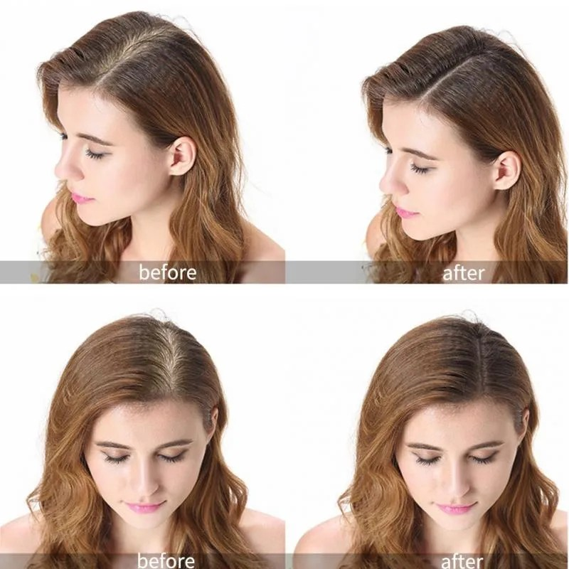 GingerGrow™ Professional Hair Care Kit - Timeless Beauty