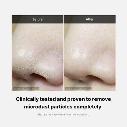 Zero Foam Cleanser for Sensitive Skin - Sebum Control, Moisture Balance, and Pore Minimization | Korean Skincare - Timeless Beauty