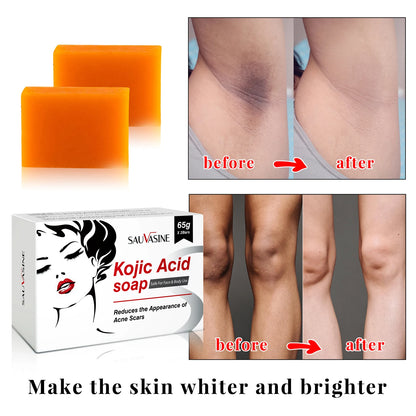 65G X2 Kojic Acid Soap Skin Lightening Even Skin Tone Facial Deep Cleaning Oil Control Moisturizing Skin Care Beauty Health - Timeless Beauty