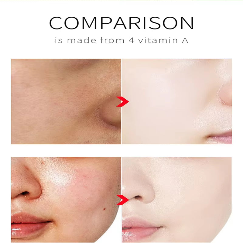10Ml Retinol Facial Serum anti Wrinkle Fade Dark Spots Moisturizing Whitening Serum Essence Fade Acne Mark Face Skin Care - Timeless Beauty
